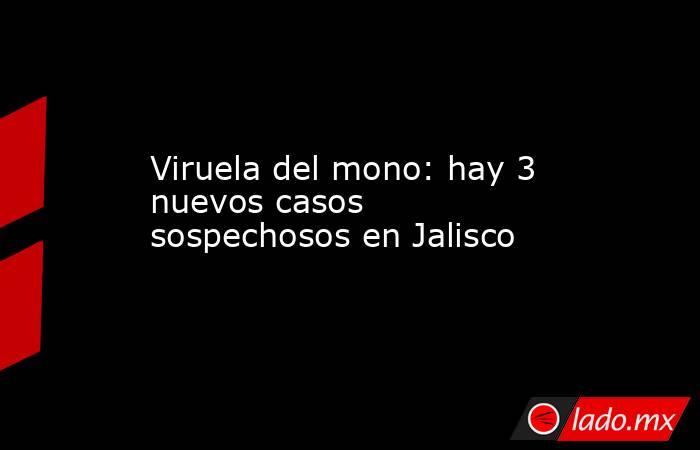 Viruela del mono: hay 3 nuevos casos sospechosos en Jalisco . Noticias en tiempo real