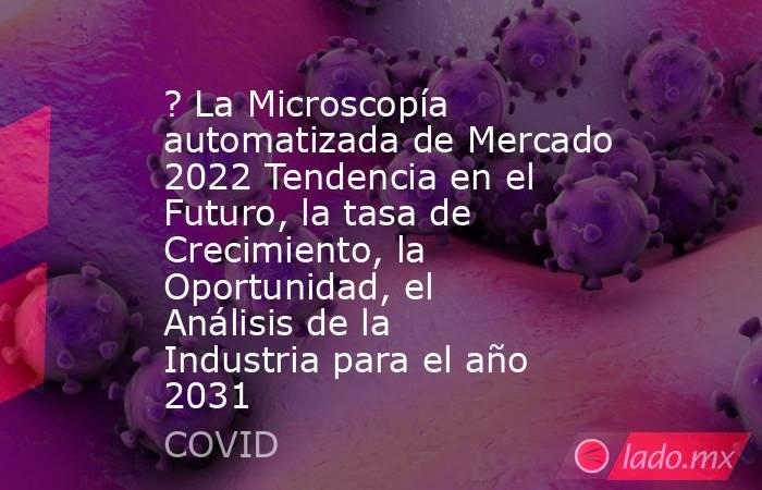 ? La Microscopía automatizada de Mercado 2022 Tendencia en el Futuro, la tasa de Crecimiento, la Oportunidad, el Análisis de la Industria para el año 2031. Noticias en tiempo real