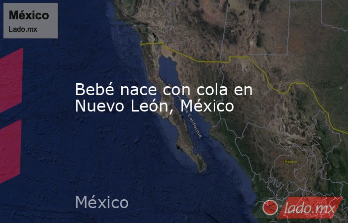Bebé nace con cola en Nuevo León, México. Noticias en tiempo real