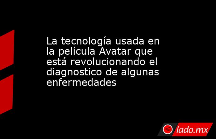 La tecnología usada en la película Avatar que está revolucionando el diagnostico de algunas enfermedades. Noticias en tiempo real