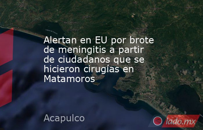 Alertan en EU por brote de meningitis a partir de ciudadanos que se hicieron cirugías en Matamoros. Noticias en tiempo real