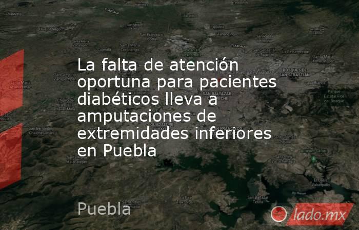 La falta de atención oportuna para pacientes diabéticos lleva a amputaciones de extremidades inferiores en Puebla. Noticias en tiempo real