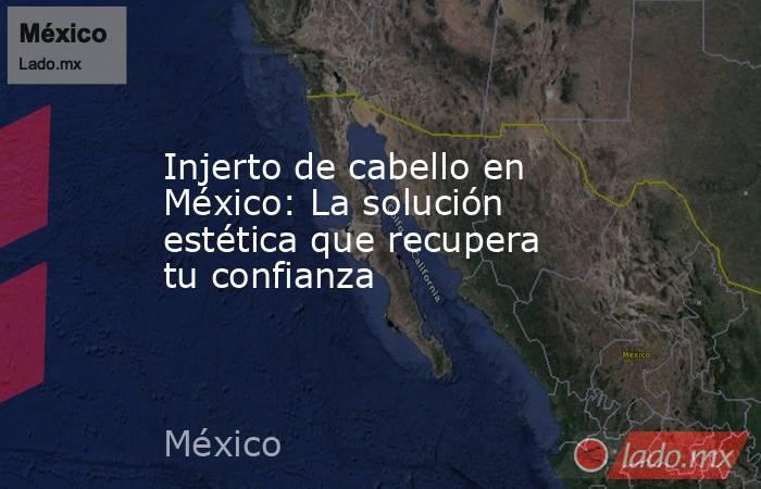 Injerto de cabello en México: La solución estética que recupera tu confianza
