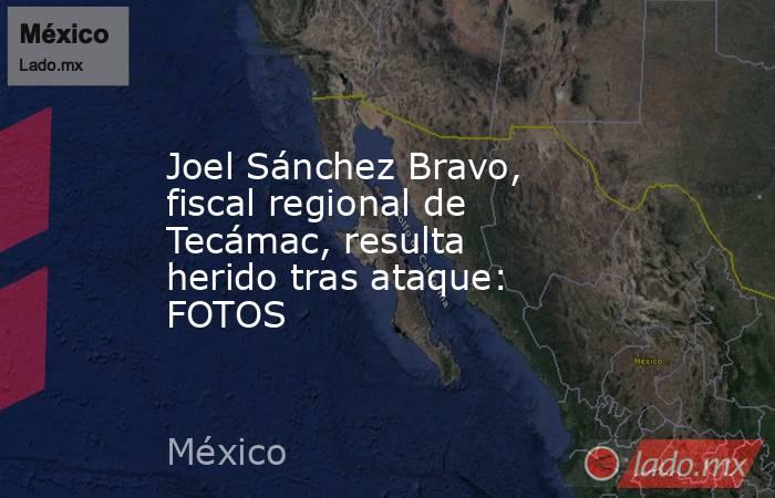 Joel Sánchez Bravo, fiscal regional de Tecámac, resulta herido tras ataque: FOTOS. Noticias en tiempo real