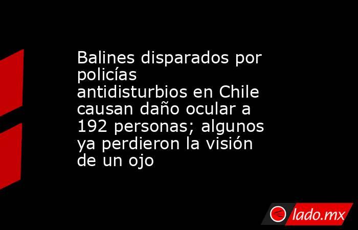 Balines disparados por policías antidisturbios en Chile causan daño ocular a 192 personas; algunos ya perdieron la visión de un ojo. Noticias en tiempo real