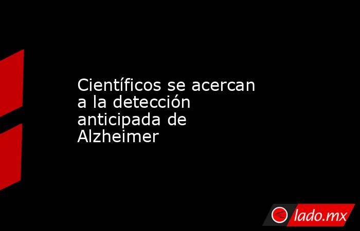 Científicos se acercan a la detección anticipada de Alzheimer
. Noticias en tiempo real