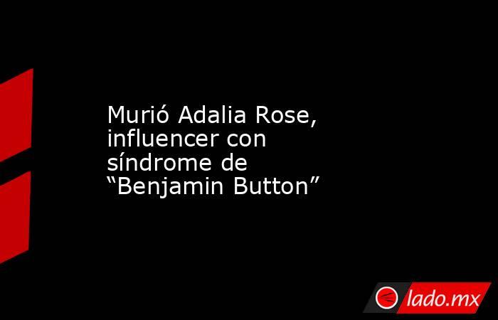 Murió Adalia Rose, influencer con síndrome de “Benjamin Button”. Noticias en tiempo real